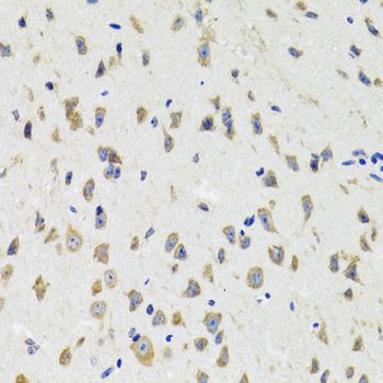 Immunohistochemistry - IKBKG Polyclonal Antibody (144-00917)