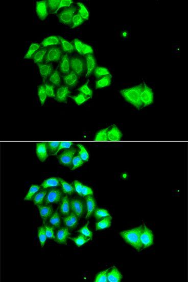 Immunofluorescence - Rad51D antibody (144-07534)