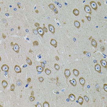 Immunohistochemistry - PDE1B antibody (144-02102)