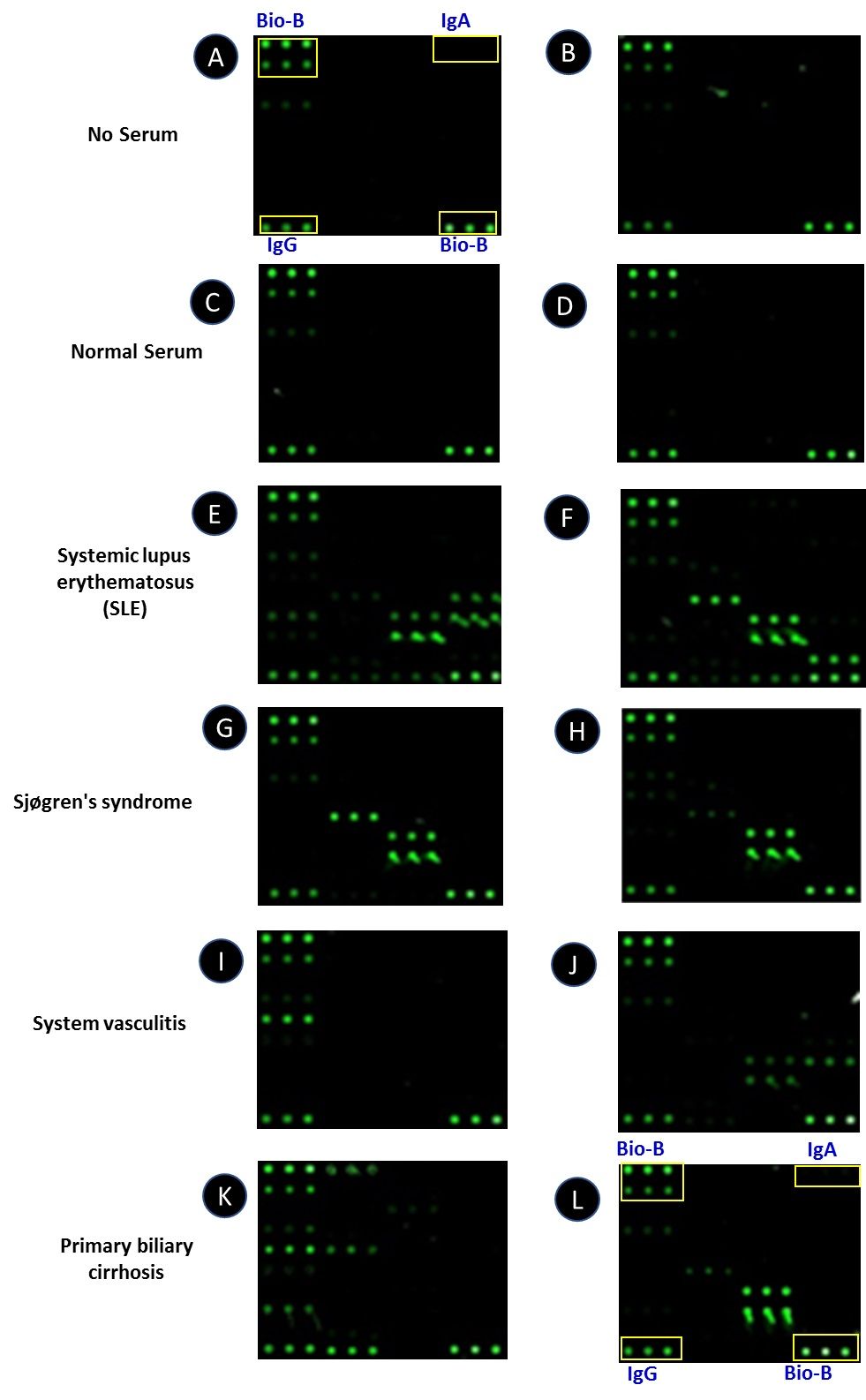 Typical result using serum on the RayBio<sup>®</sup> Autoimmune Disease IgG Autoantibody Detection Array.