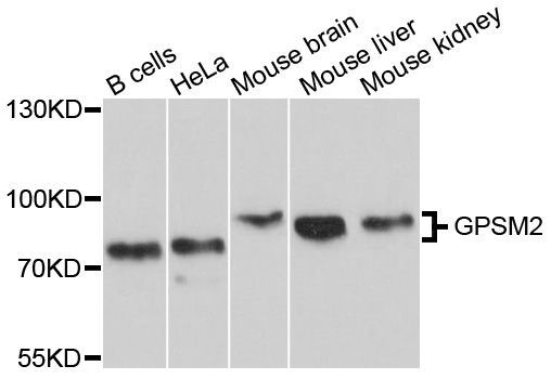 Western blot - GPSM2 Polyclonal Antibody (144-10553)