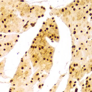 Immunohistochemistry - Lamin A/C Polyclonal Antibody (144-00249)