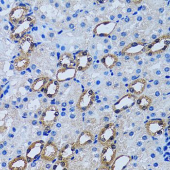 Immunohistochemistry - IMPA1 antibody (144-06381)