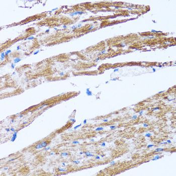 Immunohistochemistry - Caspase3 Polyclonal Antibody (144-60067)