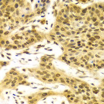 Immunohistochemistry - ELAVL1 Polyclonal Antibody (144-01608)