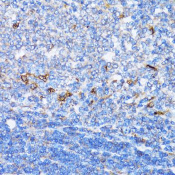 Immunohistochemistry - NDE1 antibody (144-07112)