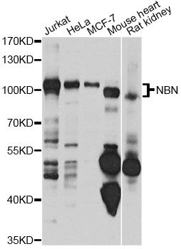 Western blot - NBN antibody (144-07703)