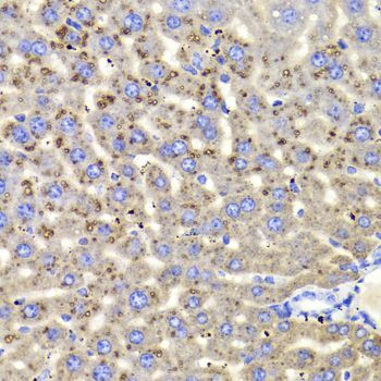 Immunohistochemistry - HSD17B13 Antibody (144-06256)