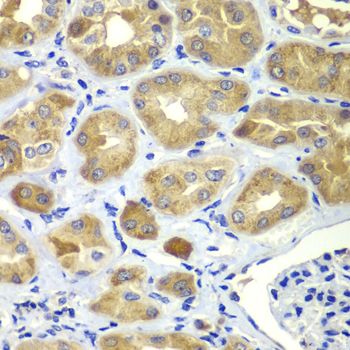Immunohistochemistry - SHC1 antibody (144-07725)