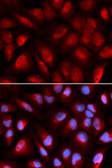 Immunofluorescence - MCM5 antibody (144-05556)