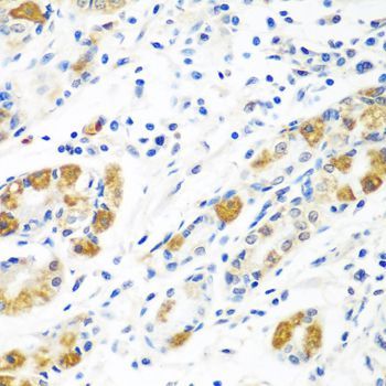Immunohistochemistry - BLVRB antibody (144-07260)