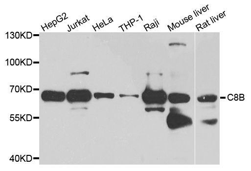 Western blot - C8B antibody (144-08324)