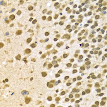 Immunohistochemistry - [KO Validated] HNRNPA2B1 Polyclonal Antibody (144-01162)