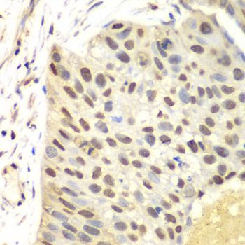 Immunohistochemistry - FEN1 Polyclonal Antibody (144-01175)