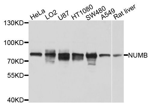 Western blot - NUMB antibody (144-09352)
