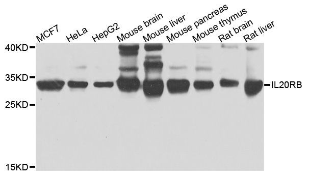 Western blot - IL20RB antibody (144-07980)