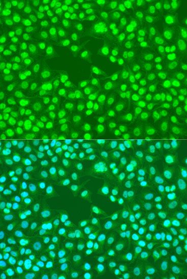 Immunofluorescence - RAD23B Polyclonal Antibody (144-01034)