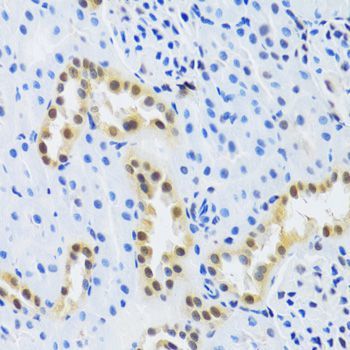 Immunohistochemistry - DDB1 Polyclonal Antibody (144-02896)
