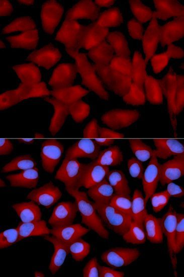 Immunohistochemistry - EIF5A Polyclonal Antibody (144-02016)