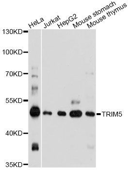 Western blot - TRIM5 antibody (144-61324)