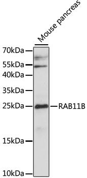 Western blot