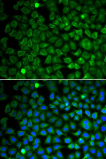 Immunofluorescence - NUP62 antibody (144-02499)