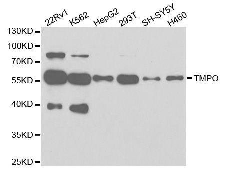 Western blot - [KO Validated] TMPO Polyclonal Antibody (144-02534)