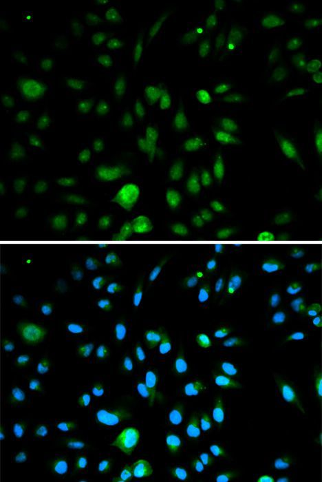 Immunofluorescence - CDKN2A Polyclonal Antibody (144-00262)