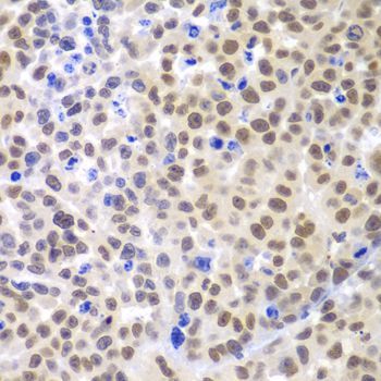 Immunohistochemistry - LHX4 antibody (144-08072)