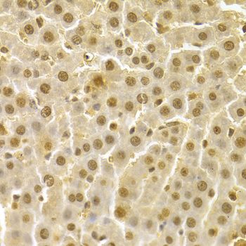 Immunohistochemistry - CDK4 Polyclonal Antibody (144-00366)