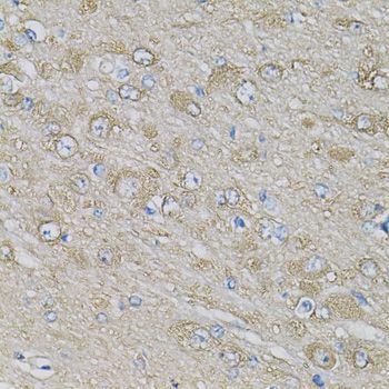 Immunohistochemistry - EIF3H Polyclonal Antibody (144-013378)