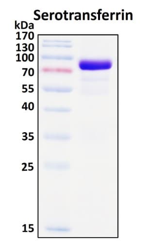SDS-PAGE Image