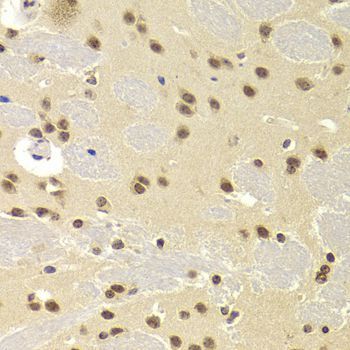 Immunohistochemistry - SNRPA Antibody (144-06410)