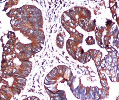 IHC