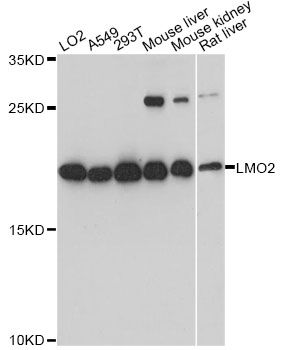 Western blot - LMO2 Polyclonal Antibody (144-01903)