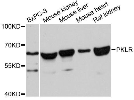 Western blot - PKLR antibody (144-12084)