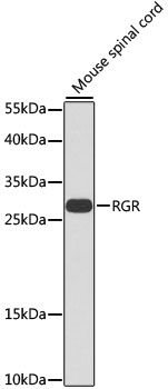 Western blot - RGR Polyclonal Antibody (144-07925)