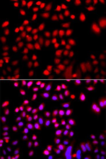 Immunofluorescence - CFL2 antibody (144-08009)