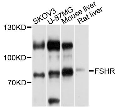 Western blot - FSHR antibody (144-01480)