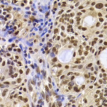 Immunohistochemistry - HIRIP3 antibody (144-07014)