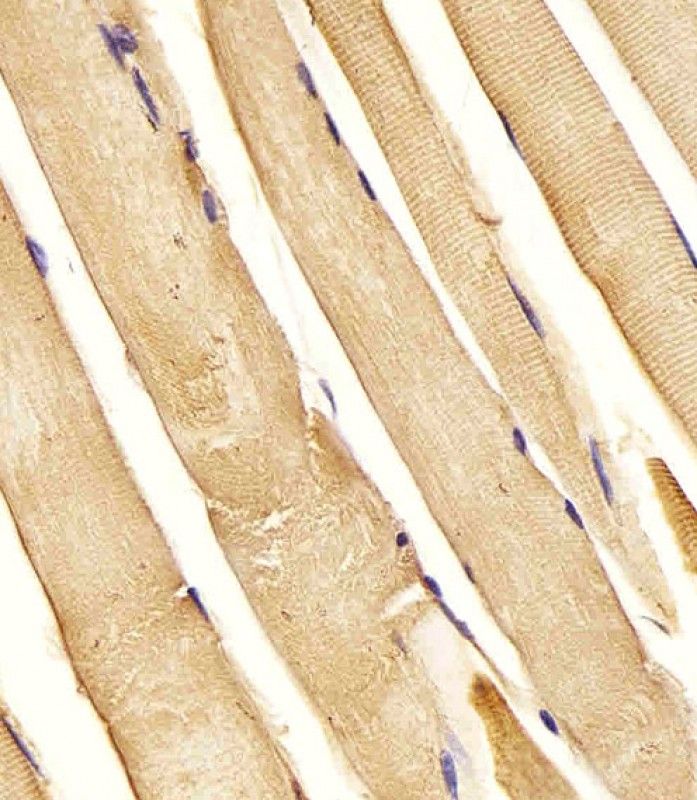IHC-P