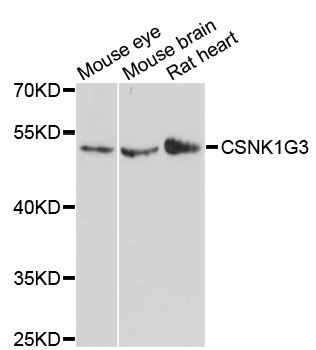 Western blot - CSNK1G3 antibody (144-013013)