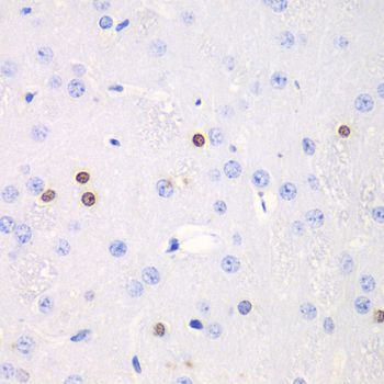 Immunohistochemistry - TKT antibody (144-013553)