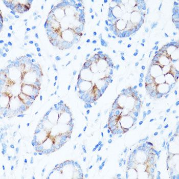 Immunohistochemistry - GSK3B Polyclonal Antibody (144-06164)