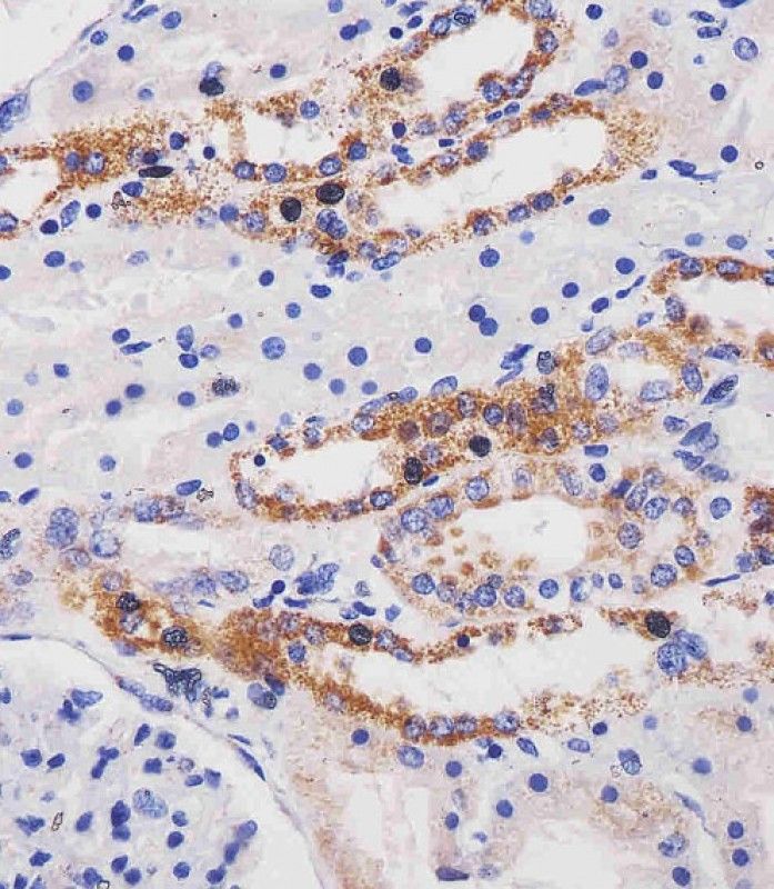 IHC-P