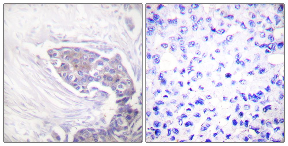 IHC