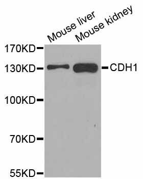 Western blot - CDH1 Polyclonal Antibody (144-011492)