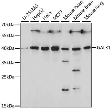 Western blot - GALK1 antibody (144-015274)