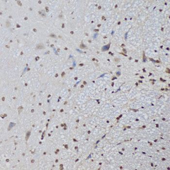 Immunohistochemistry - CTCF Polyclonal Antibody (144-60257)