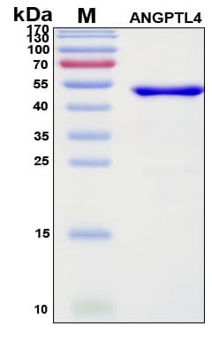 SDS-PAGE Image